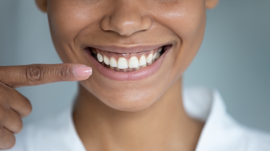 woman smiling after enamel shaping or tooth contouring